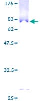 Human TTLL1 Protein (Recombinant GST)