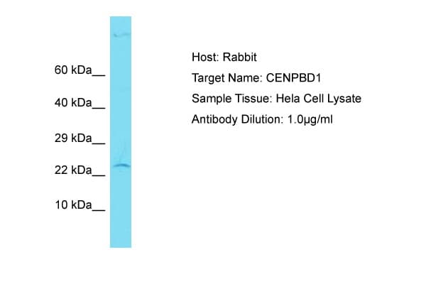 Polyclonal Rabbit anti-Human CENPBD1 Antibody (aa55-104, WB)