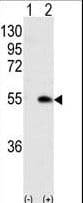 CAMK1G / CaMKI gamma Antibody (aa211-241)
