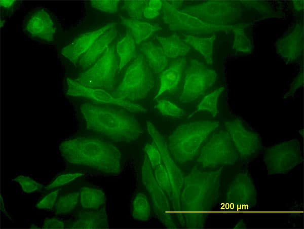 IHC-plus™ Monoclonal Mouse anti-Human TUBA4A / TUBA1 Antibody (clone 2E11, IHC, IF, WB)