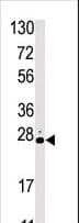 STK19 Antibody (aa278-308)