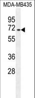 AKAP17A / 721P Antibody (aa307-336)