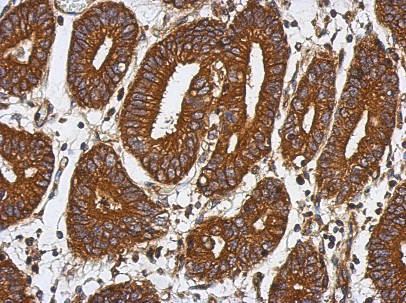 Polyclonal Rabbit anti-Human ABHD16A / BAT5 Antibody (IHC, WB)