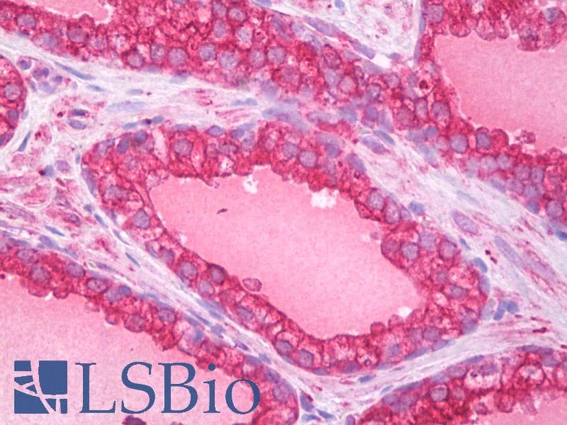 IHC-plus™ Monoclonal Mouse anti-Human APG5 / ATG5 Antibody (aa8-318, IHC, WB)