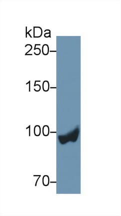 PYGL Antibody (aa73-267)