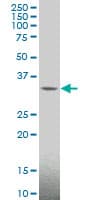 Monoclonal Mouse anti-Human MAGEA4 Antibody (clone 3D12, IF, WB)