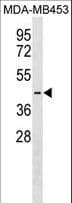 DFNB59 / PJVK Antibody (aa170-197)