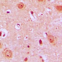 PTGR2 / PGR2 Antibody (Internal)