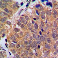 CDKN2C / p18 INK4c Antibody (C-Terminus)