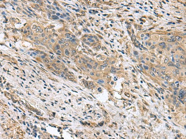 PAPSS2 Antibody