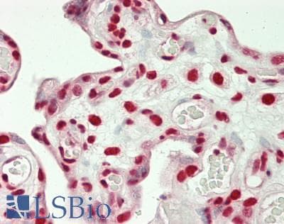 IHC-plus™ Polyclonal Rabbit anti-Human RALY Antibody (aa256-306, IHC, WB)