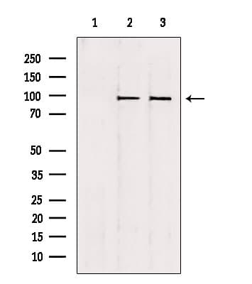 Polyclonal Rabbit anti-Human NSUN2 Antibody (IHC, IF, WB)