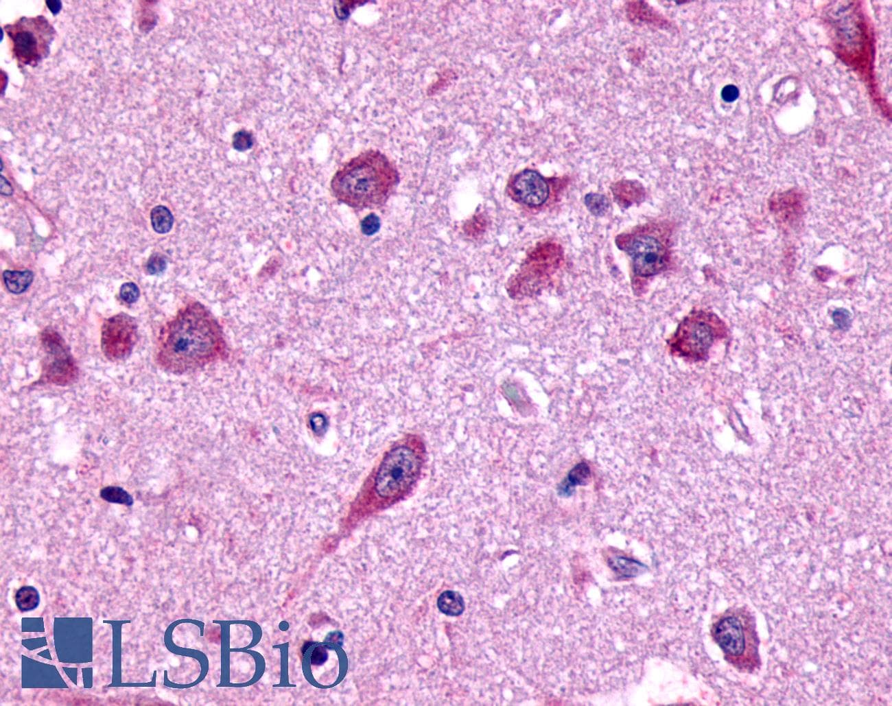 PathPlus™ FZD8 / Frizzled 8 Antibody (N-Terminus)
