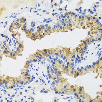 UVRAG Antibody