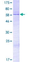 Human HOXD13 Protein (Recombinant GST)