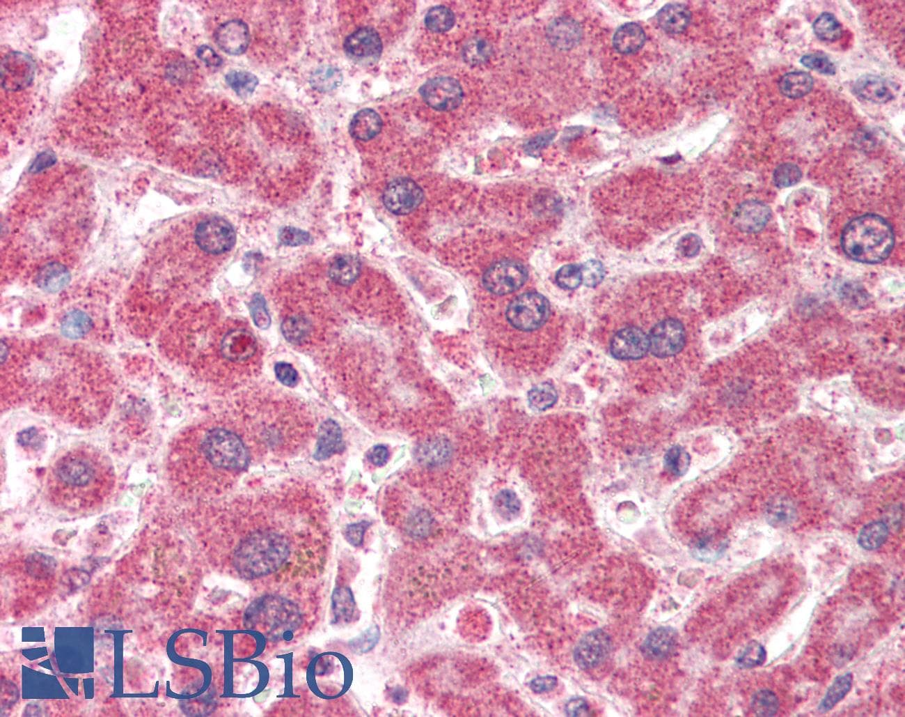 IHC-plus™ Polyclonal Goat anti-Human IFT74 / CCDC2 Antibody (aa588-600, IHC, WB)