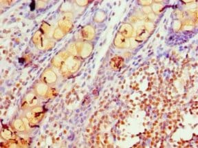 Polyclonal Rabbit anti-Human KCNN4 / KCa3.1 Antibody (aa288-427, IHC)