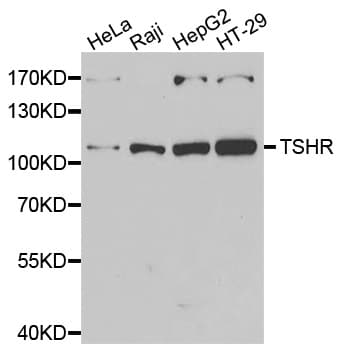 TSH Receptor / TSHR Antibody