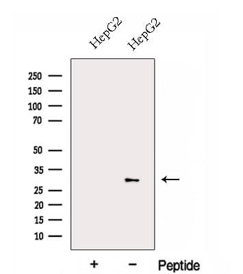 FBG4 / FBXO17 Antibody