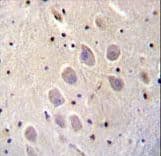 NGFR / CD271 / TNR16 Antibody (aa353-380)