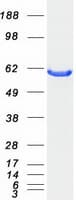 Human CBS Protein (Recombinant Myc-DDK (Flag))