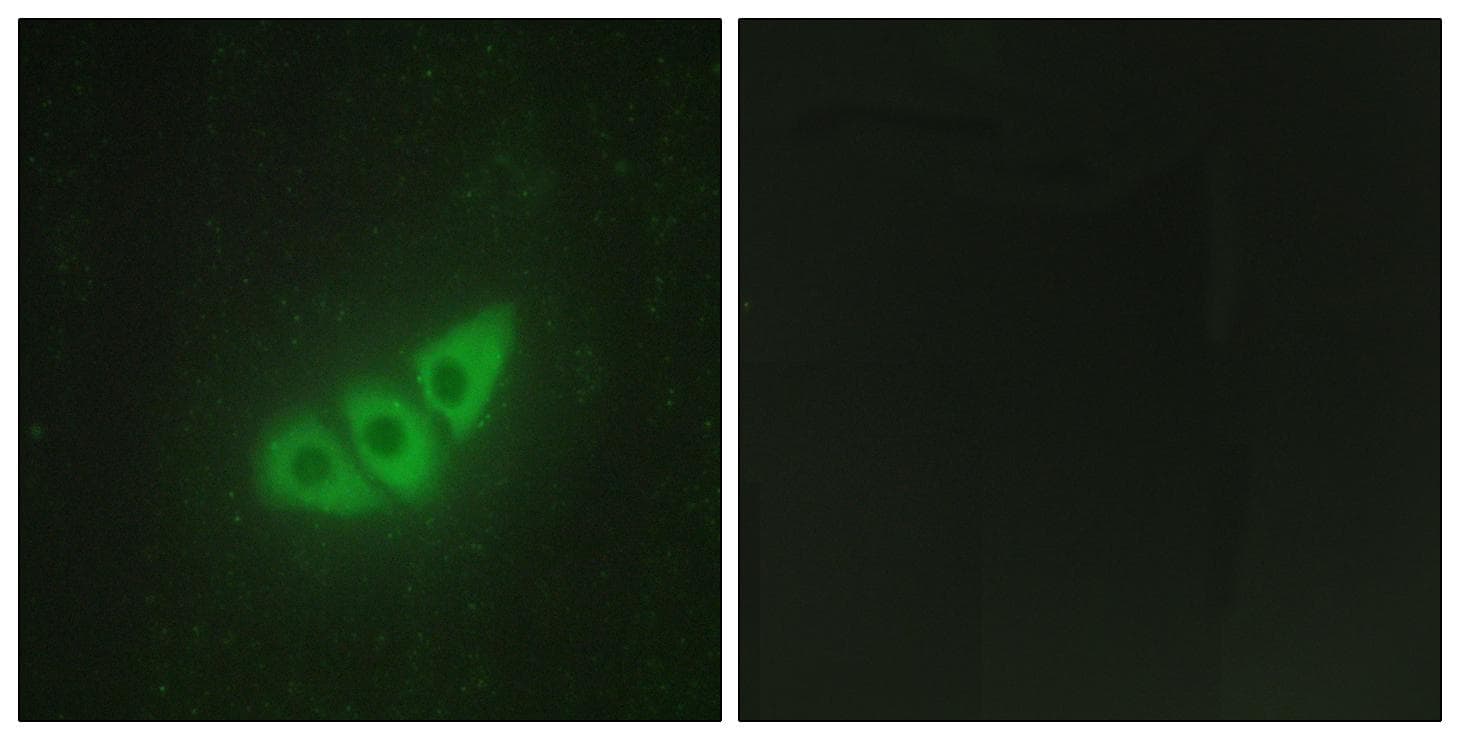 Polyclonal Rabbit anti-Human EIF2AK3 / PERK Antibody (IF, WB)