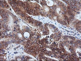 CAST / Calpastatin Antibody (clone OTI1E7)