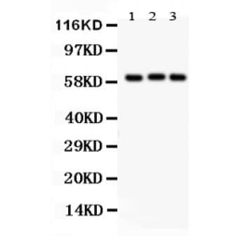HPSE / Heparanase Antibody (aa301-331)