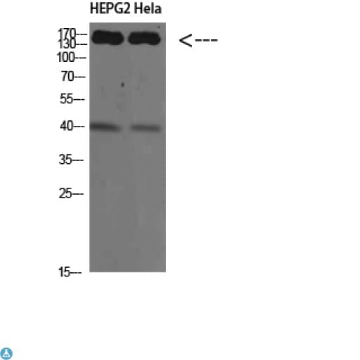 CYFIP2 / PIR121 Antibody