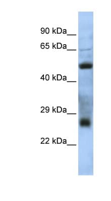 Polyclonal Rabbit anti-Human C7orf62 Antibody (aa35-84, WB)