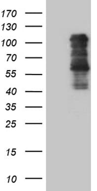 TBX3 Antibody (aa244-481, clone OTI8G5, Carrier-free)
