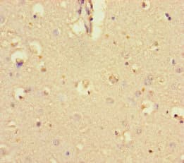 Polyclonal Rabbit anti-Human KCTD16 Antibody