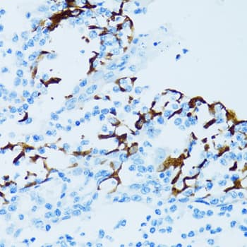 Polyclonal Rabbit anti-Human CTSE / Cathepsin E Antibody (IHC, IF, WB)