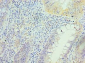PRDX5 / Peroxiredoxin 5 Antibody (aa53-214)
