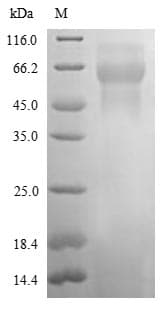 Rat NGN / Neogenin Protein (Recombinant 6His, N-terminus)