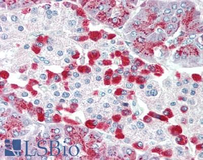 IHC-plus™ Polyclonal Rabbit anti-Human KCNJ1 / ROMK Antibody (IHC, WB)