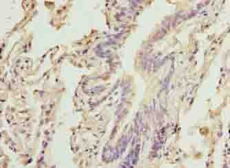 CAPN6 / Calpain 6 Antibody