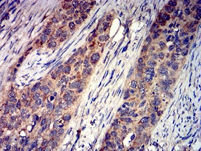 Monoclonal Mouse anti-Human GRIK4 / KA1 Antibody (clone 8H5G5, IHC, WB)
