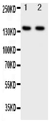 Polyclonal Rabbit anti-Human ZEB2 / SIP-1 Antibody (aa948-962, WB)