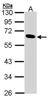 Polyclonal Rabbit anti-Human PNLIP / PL / Pancreatic Lipase Antibody (aa21-300, IHC, WB)
