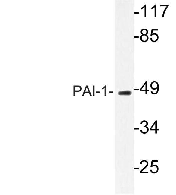 SERPINE1 / PAI-1 Antibody (aa300-400)