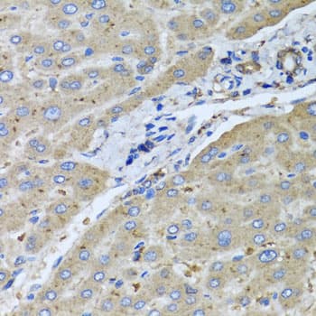 Polyclonal Rabbit anti-Human UGT2B10 Antibody (IHC, WB)