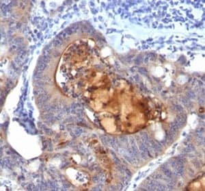 ECM1 Antibody (clone ECM1/792)