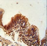 NME9 / TXNDC6 Antibody (aa111-139)