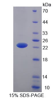 Mouse Lcn5 / Lipocalin 5 Protein (Recombinant His-T7)