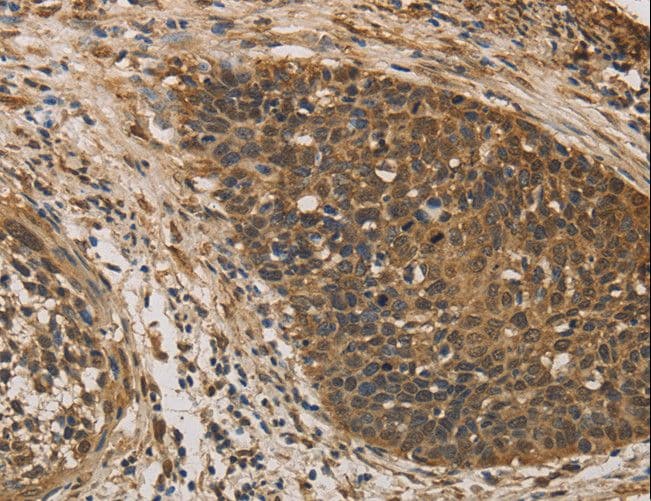 Polyclonal Rabbit anti-Human DACH / DACH1 Antibody (IHC)