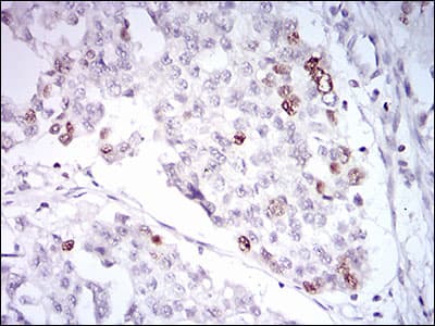 TERF2 / TRF2 Antibody (aa324-500, clone 3H6B4)