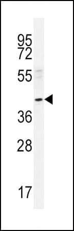 NEU2 / Sialidase 2 Antibody (aa23-50)