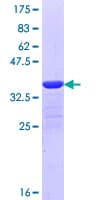 Human MYLK4 Protein (Recombinant GST, N-terminus)