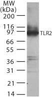 TLR2 Antibody (aa180-196)